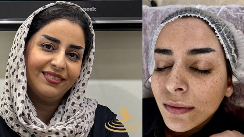 درمان قطعی کک و مک در کلینیک دکتر فاخته